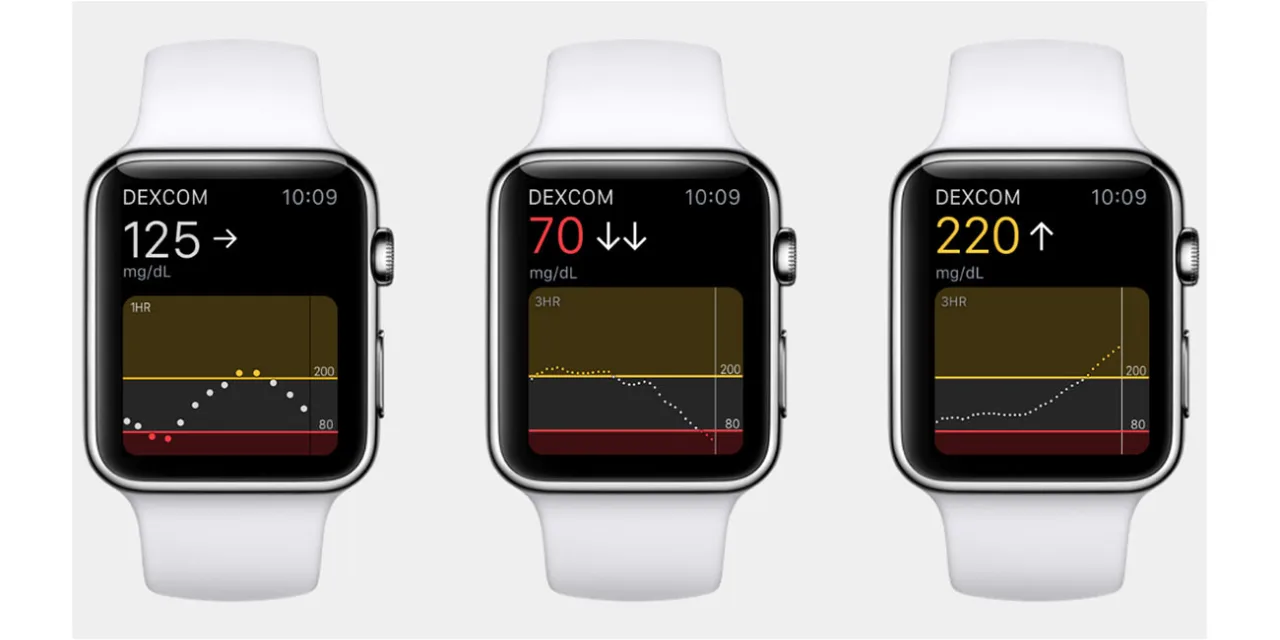 Types of actuary: Apple Watch blood sugar measurement